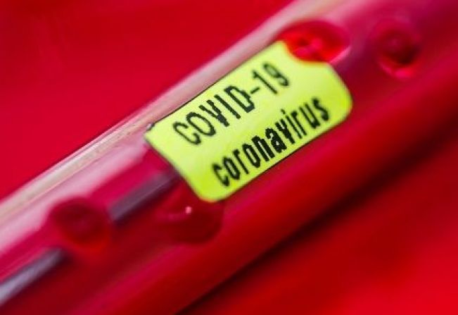  Novo coronavírus em Glória-BA: boletim Informa mais 2 casos positivos, na área rural